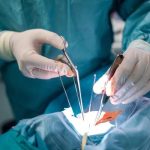 Expert Guidance from a Breast Reconstruction Surgeon Near Me